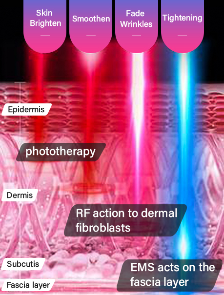 EMS และ RF . แตกต่างกันอย่างไร